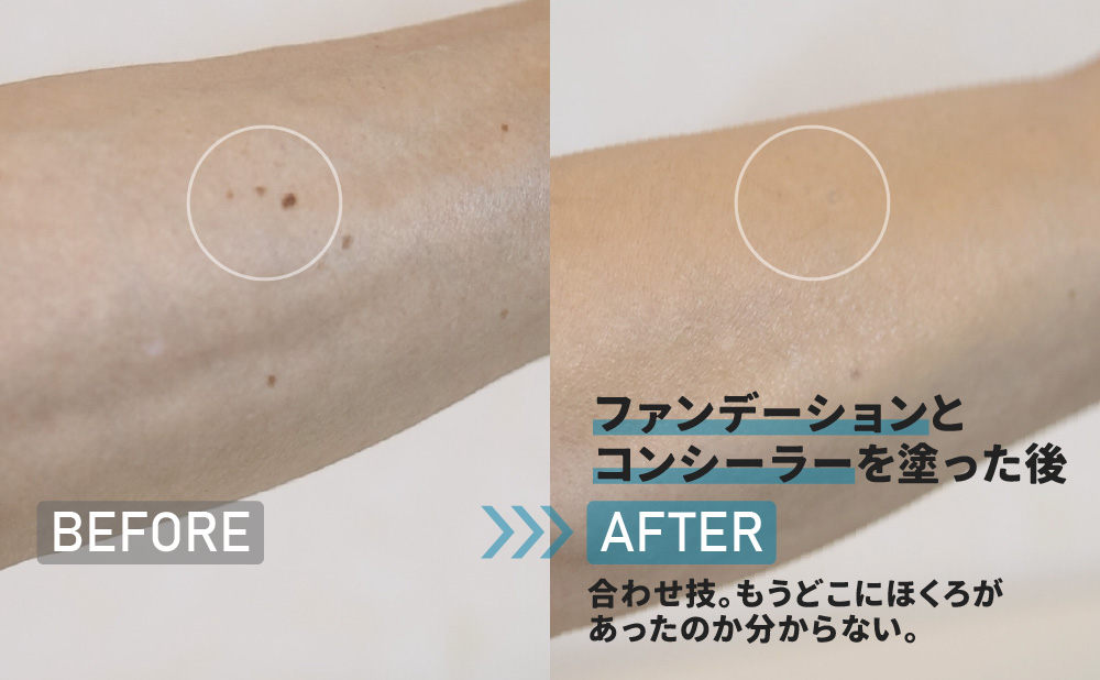ビフォーアフター_コンシーラーとファンデーションを塗った後