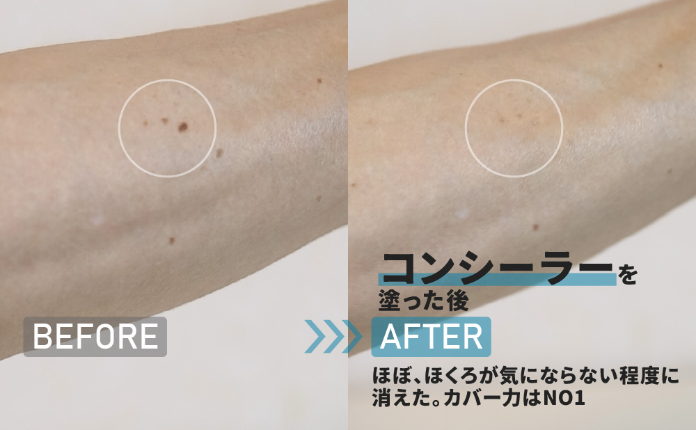 ビフォーアフター_コンシーラーを塗った後